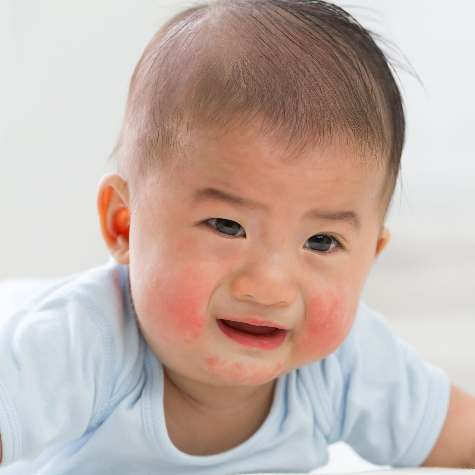 How to choose the right baby wash for baby with dermatitis